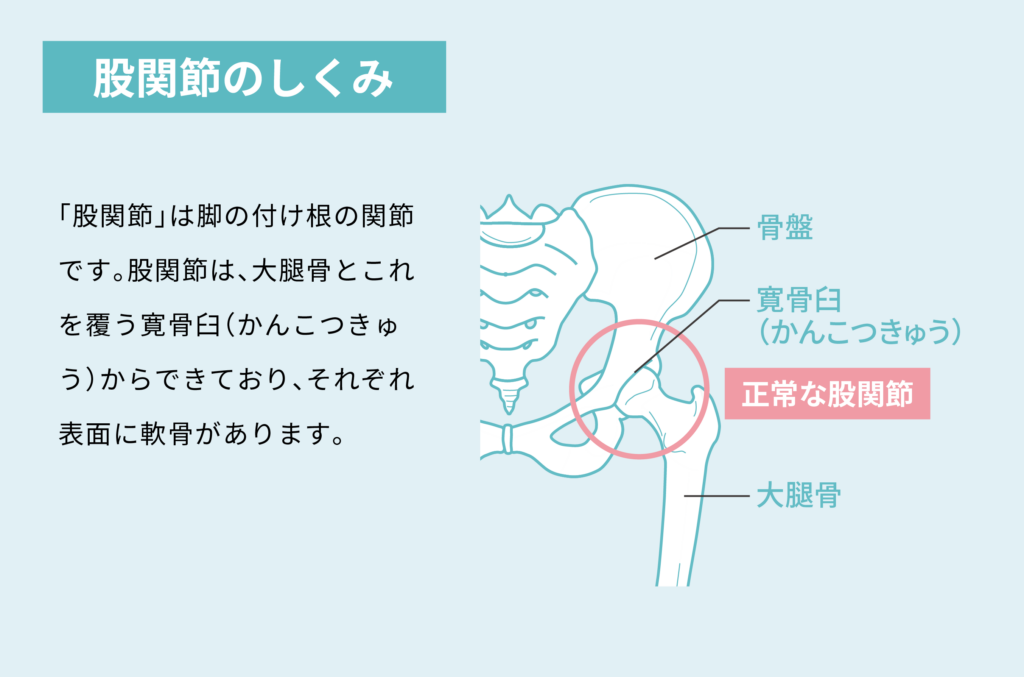 今月のテーマは 股関節 発症年齢は平均40 50歳代 特に女性に多い変形性股関節症 With Magazine Ja愛知厚生連