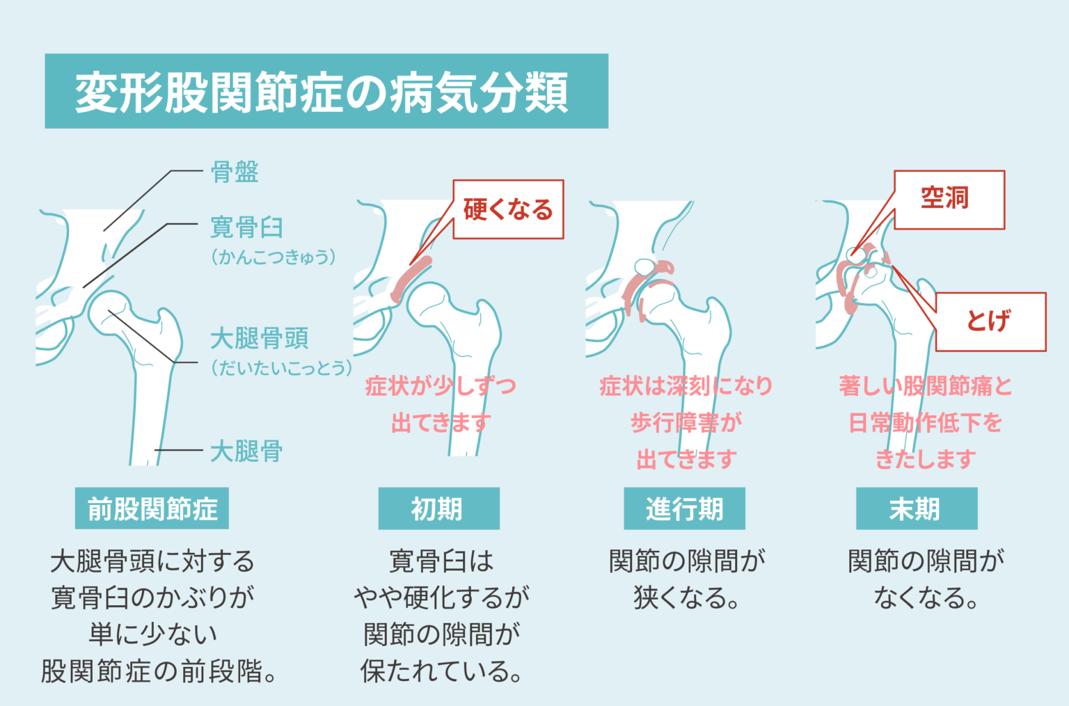 股関節疾患の治療法にはどのようなものがありますか?