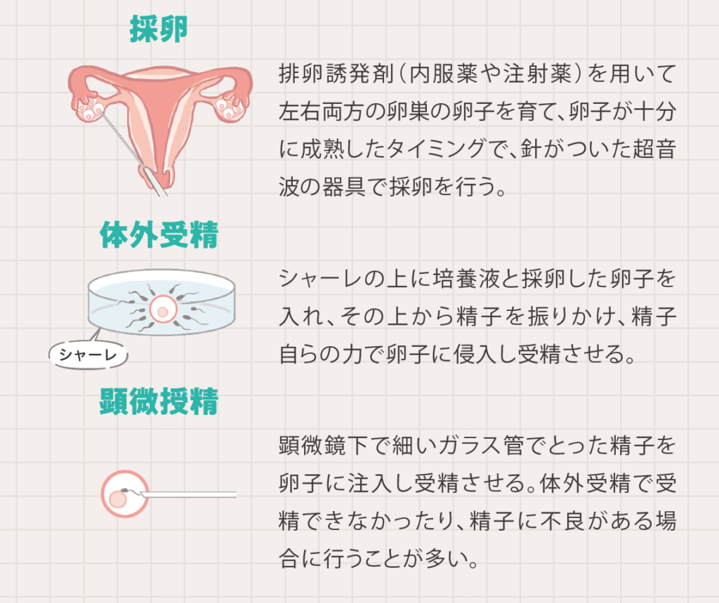 JA愛知厚生連の医師が解説／不妊治療のおはなし | With Magazine | JA