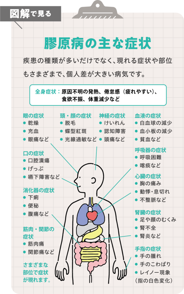 JA愛知厚生連の医師が解説／膠原病のおはなし | With Magazine | JA