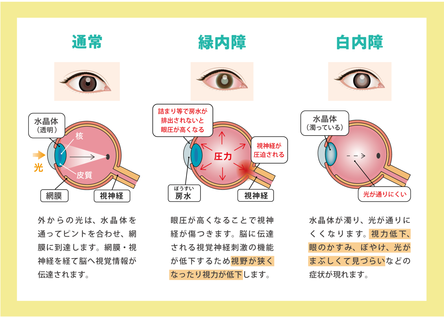 40歳を過ぎて目が見えにくいと思ったら…健診で眼底・眼圧検査を受けよう! | With Magazine | JA愛知厚生連